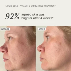 Alpha-H Liquid Gold Exfoliating Treatment with Vitamin C