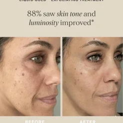 Alpha-H Liquid Gold Exfoliating Treatment with 5% Glycolic Acid