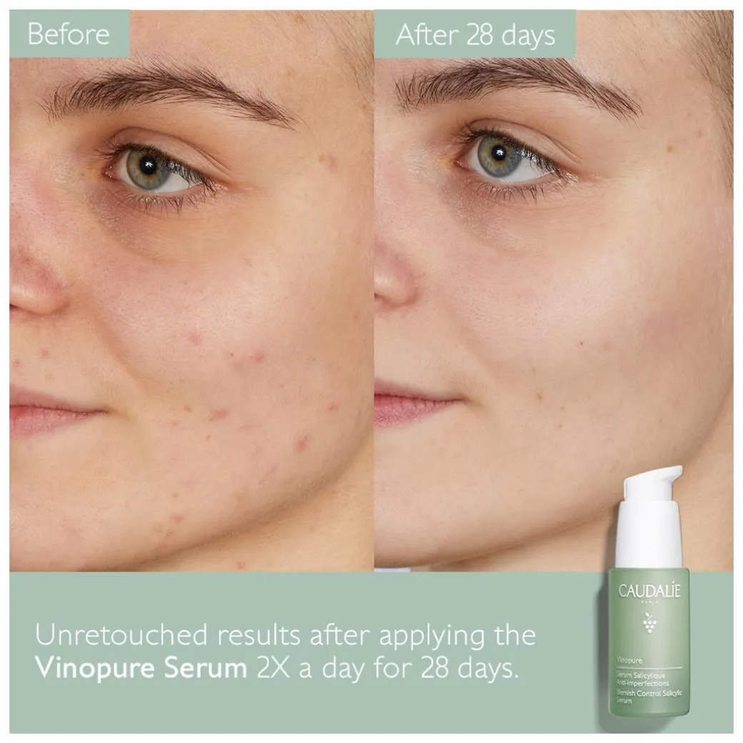 Caudalie Vinopure Blemish Control Salicylic Serum