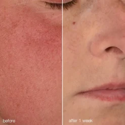 Dermalogica Ultra Calming Stablizing Repair Cream