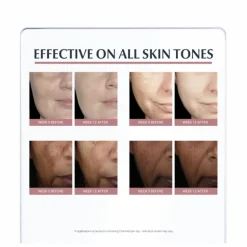 Eucerin Anti-Pigment Day Cream SPF30