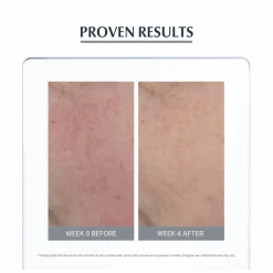 Eucerin Anti-Redness Soothing Care Cream