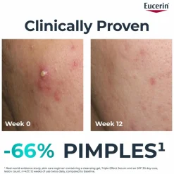 Eucerin DermoPure Triple Action Serum