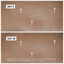 Filorga Hydra-Aox [5] Intensive Antioxidant Serum