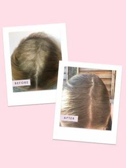 Hair Gain Hair Capsules