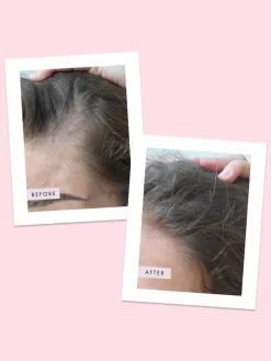 Hair Gain Scalp Foam