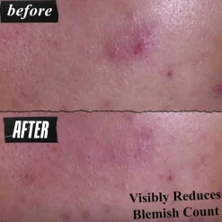 Kiehl's Gently Effective Blemish-Targeting Cleansing Paste