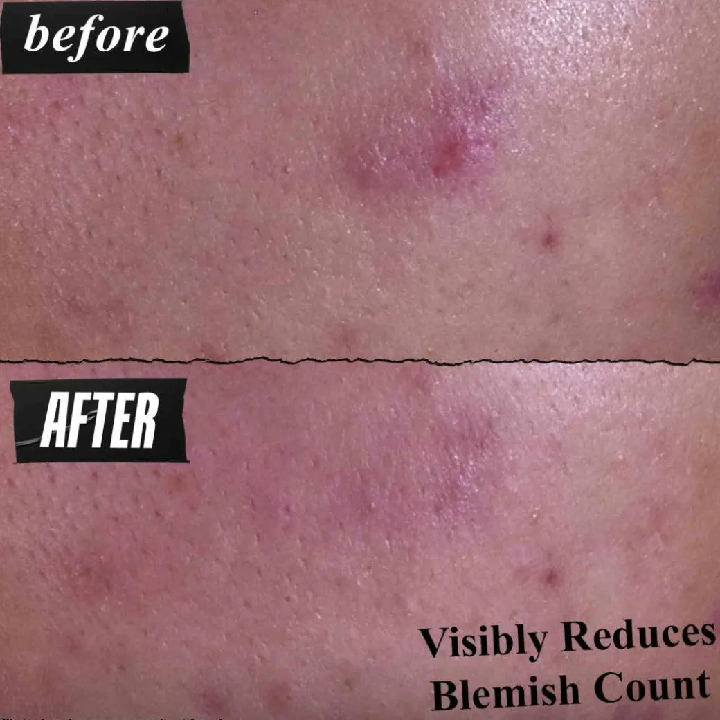 Kiehl's Gently Effective Blemish-Targeting Cleansing Paste