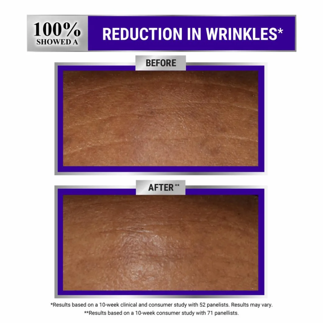 Kiehl's Retinol Skin-Renewing Daily Micro-Dose Serum