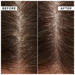 Philip Kingsley Flaky/Itchy Scalp Anti-Dandruff Scalp Mask