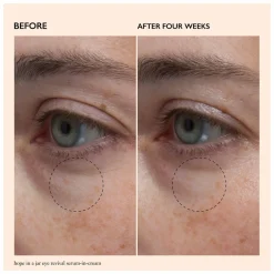 Philosophy Hope In A Jar Eye Revival Serum-in-Cream