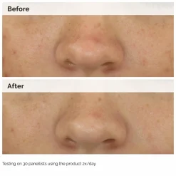 The Ordinary Balancing & Clarifying Serum