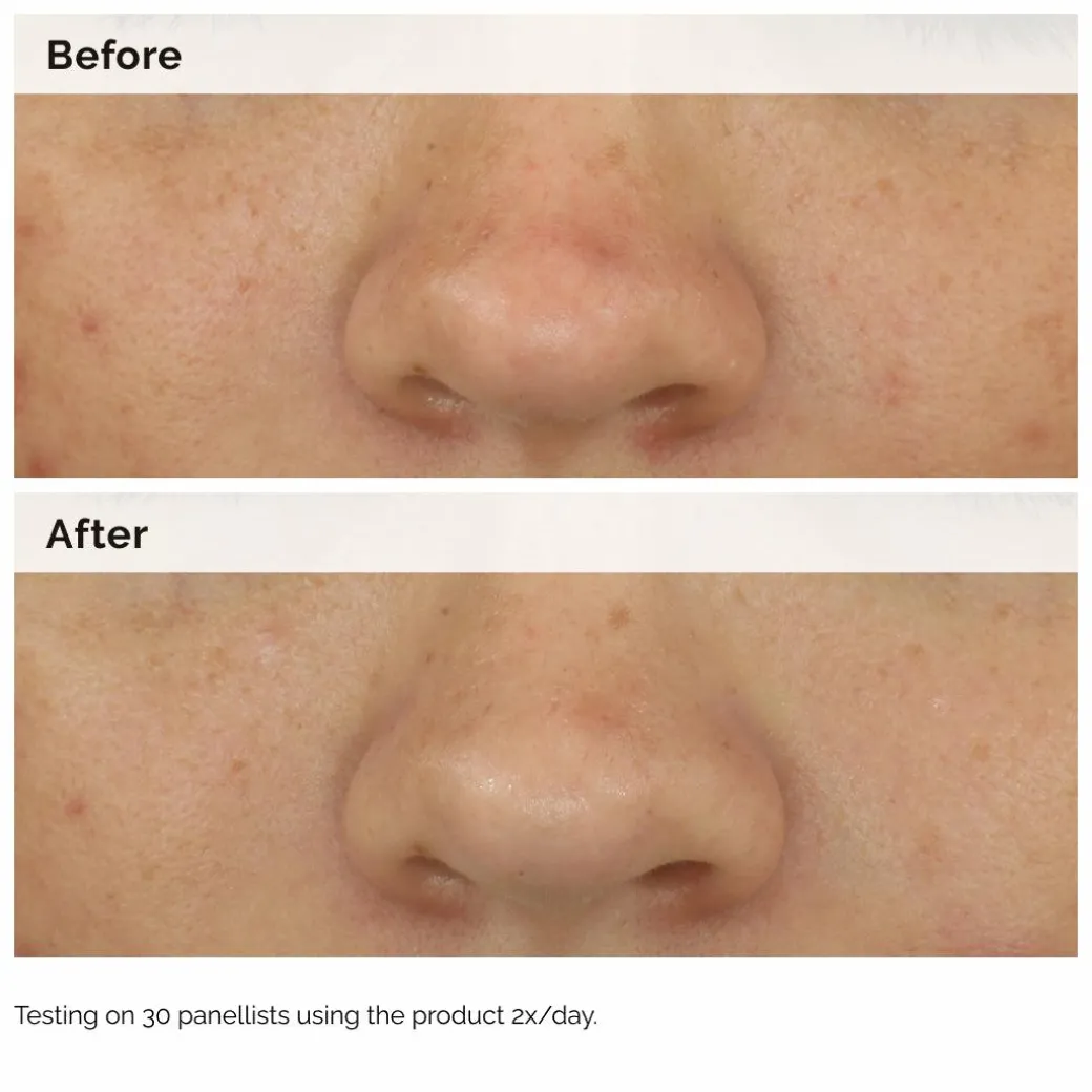 The Ordinary Balancing & Clarifying Serum