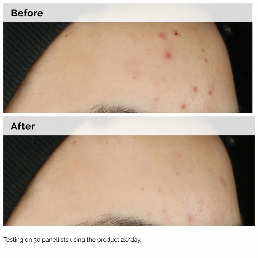 The Ordinary Balancing & Clarifying Serum