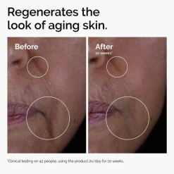 The Ordinary GF 15% Solution