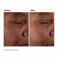 The Ordinary Glycolic Acid 7% Exfoliating Toner