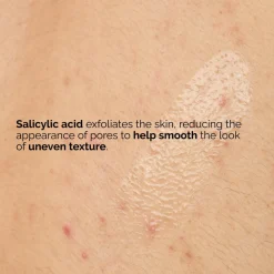 The Ordinary Salicylic Acid 0.5% Body Serum