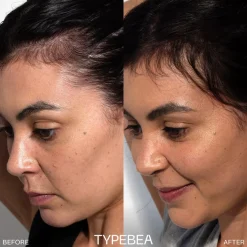 TYPEBEA G.1 Overnight Boosting Peptide Scalp Serum