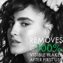 Vichy Dercos Anti-Dandruff Advanced Action Shampoo for Itchy Scalp, Dry Hair