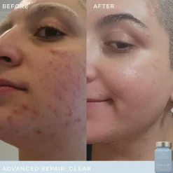 Vida Glow Advanced Repair Clear