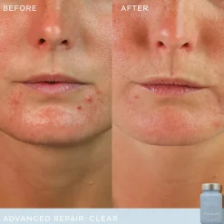 Vida Glow Advanced Repair Clear
